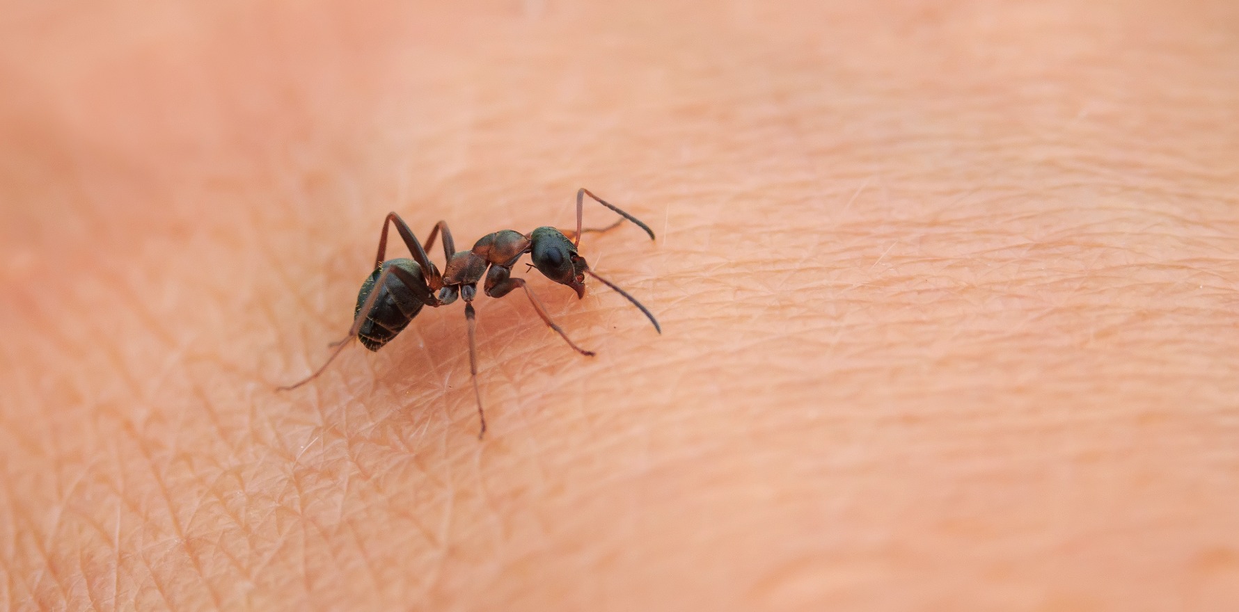 Drug relief for 'crawling ants' condition - Dermatology Republic